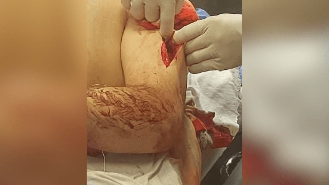 ذو أسبقيات يطعن شابا 7 طعنات ويقطع إصبعه بعد رفض "تزويجه" شقيقته