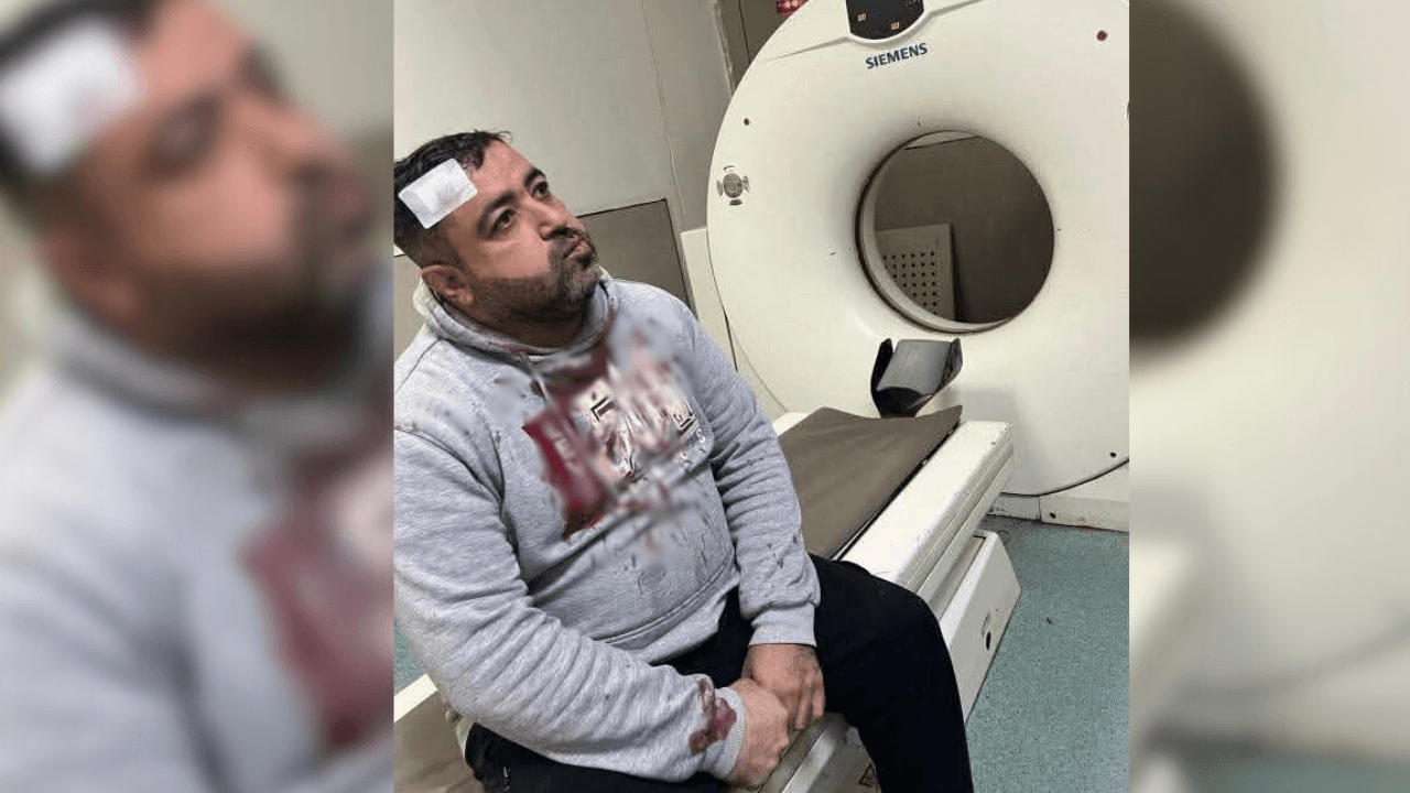 شاهد.. لحظة اعتداء ملثمين على الصحفي فيصل التميمي أمام منزله